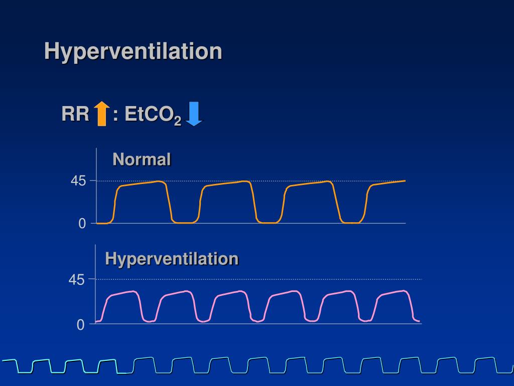 PPT CAPNOGRAPHY In Emergency Care PowerPoint Presentation, free