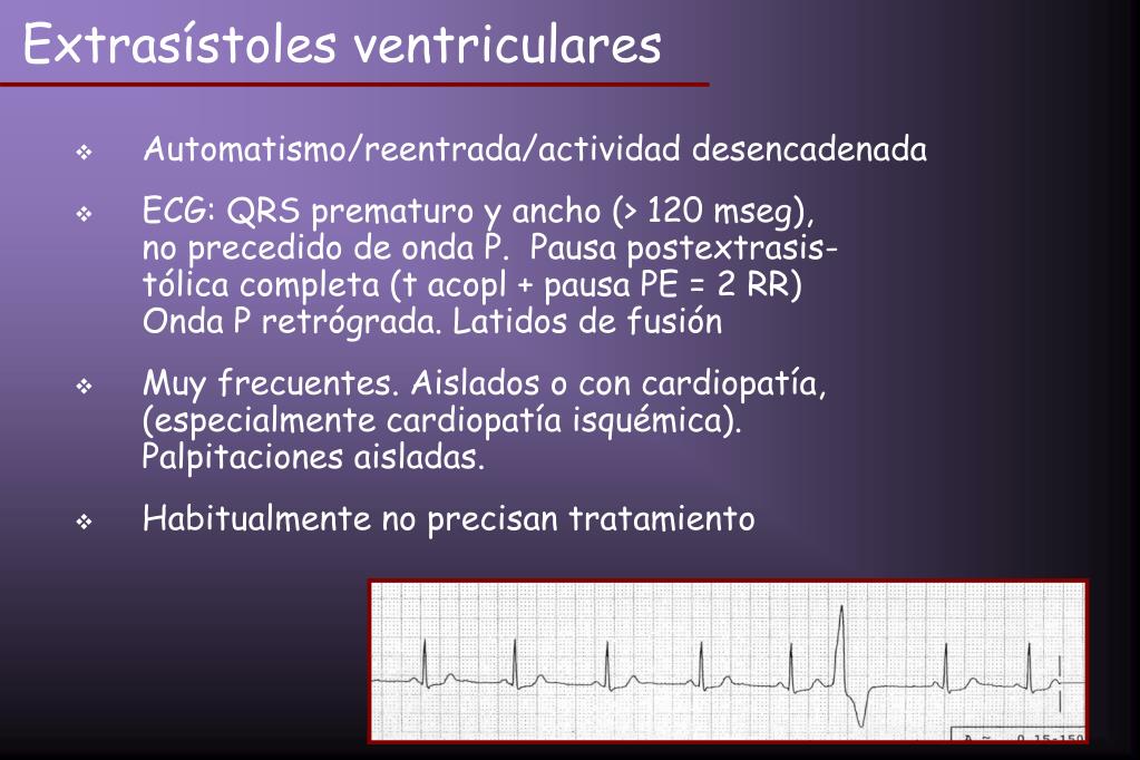 PPT Arritmias ventriculares PowerPoint Presentation, free download