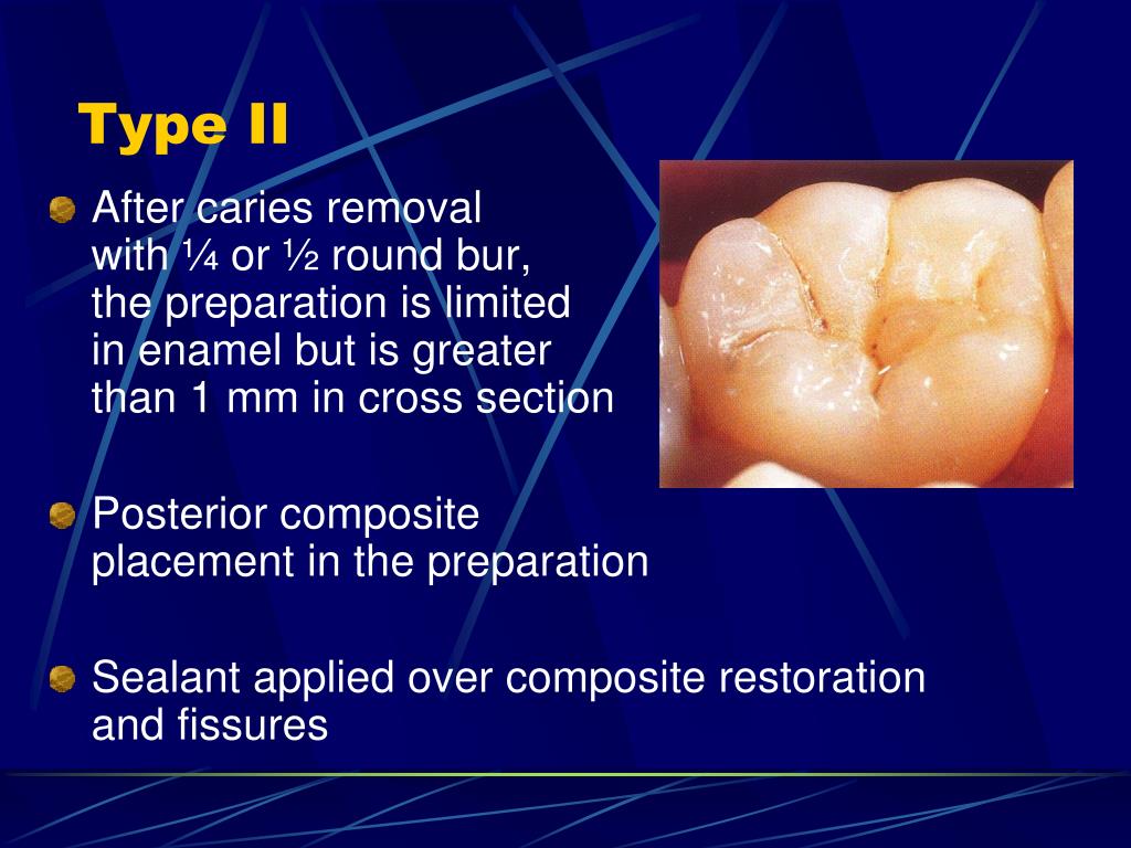 PPT Management PowerPoint Presentation, free download ID4105649