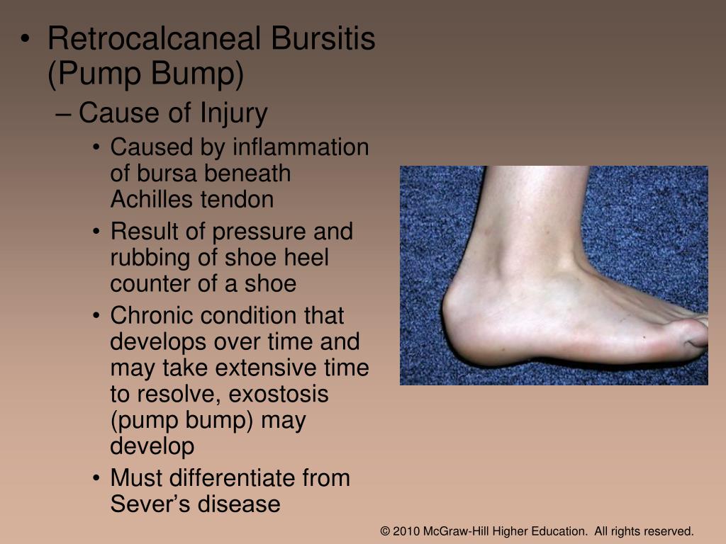 PPT Chapter 14 The Foot PowerPoint Presentation, free download ID