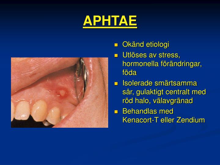 PPT MUNHÅLAN, SVALGET OCH HALSENS SJUKDOMAR PowerPoint Presentation
