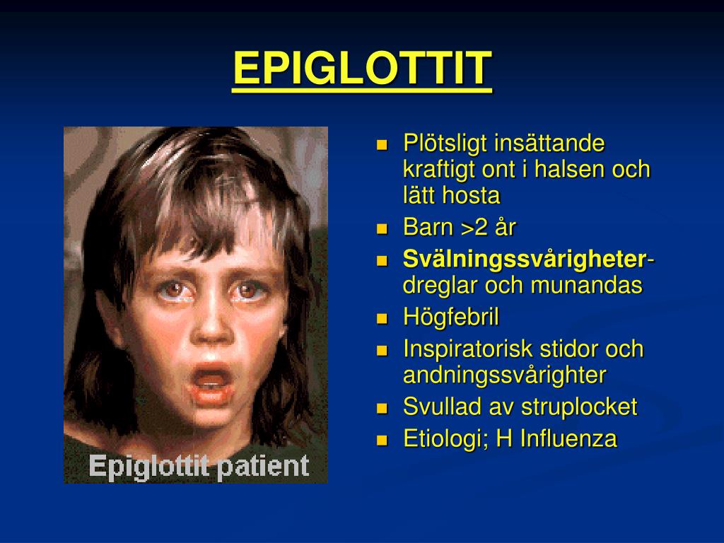 PPT MUNHÅLAN, SVALGET OCH HALSENS SJUKDOMAR PowerPoint Presentation