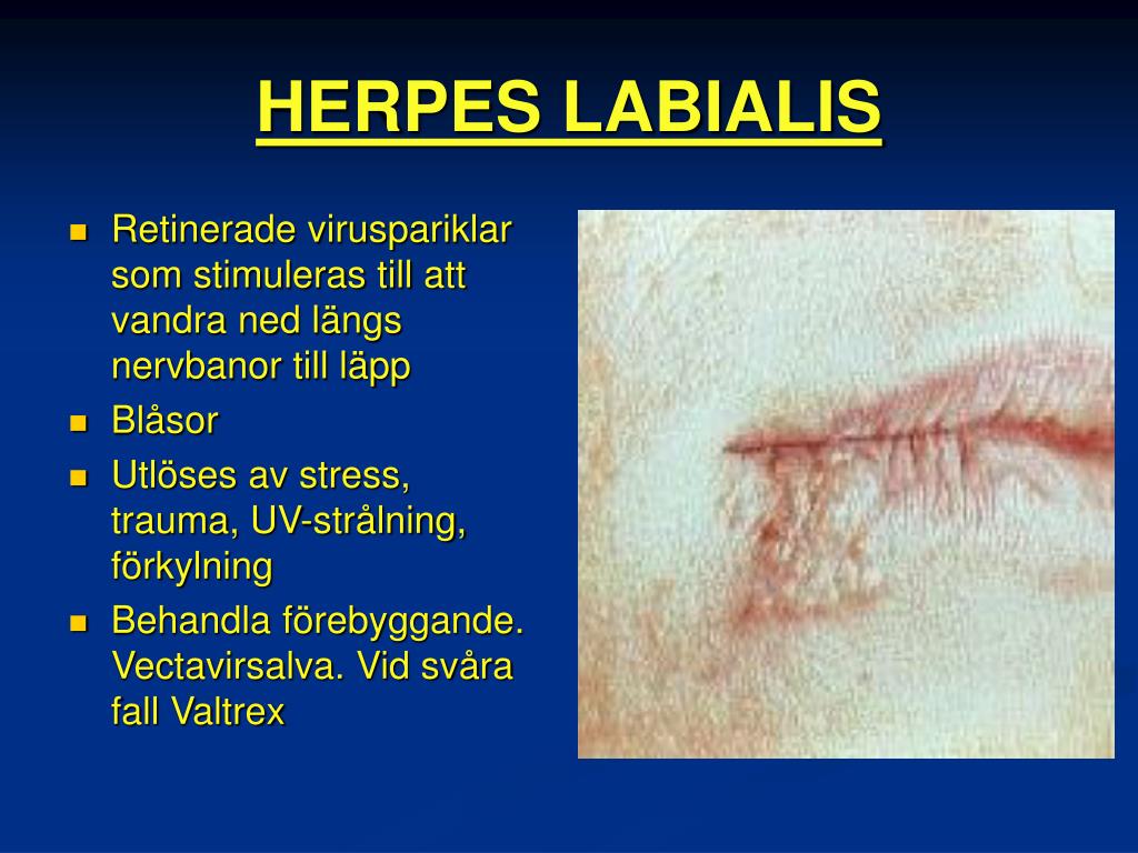 PPT MUNHÅLAN, SVALGET OCH HALSENS SJUKDOMAR PowerPoint Presentation