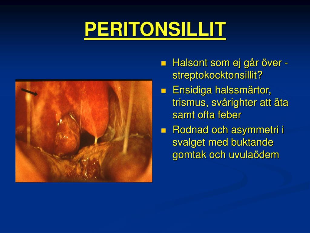 PPT MUNHÅLAN, SVALGET OCH HALSENS SJUKDOMAR PowerPoint Presentation