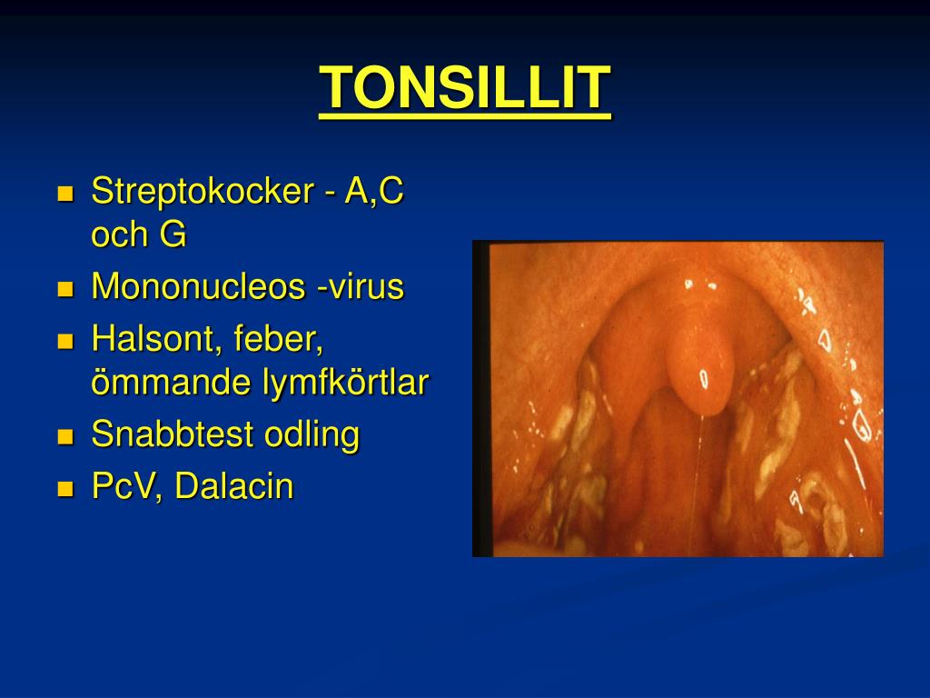 PPT MUNHÅLAN, SVALGET OCH HALSENS SJUKDOMAR PowerPoint Presentation