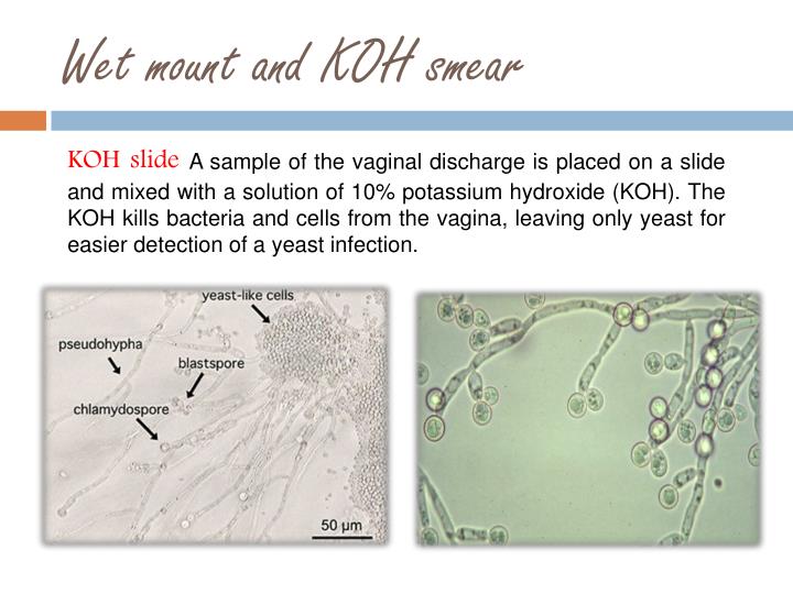 PPT Vaginal discharge culture PowerPoint Presentation ID4136140