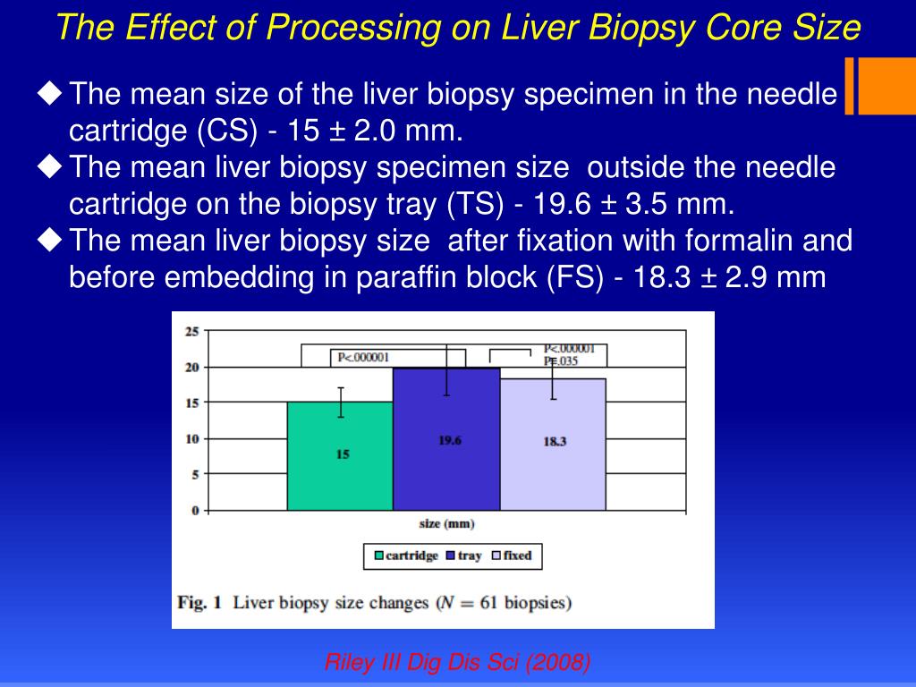 PPT What is an adequate size liver biopsy specimen PowerPoint