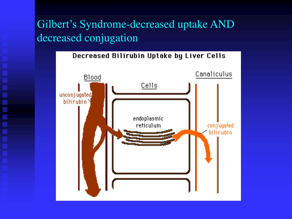 PPT Jaundice Workup of Liver Disease PowerPoint Presentation, free