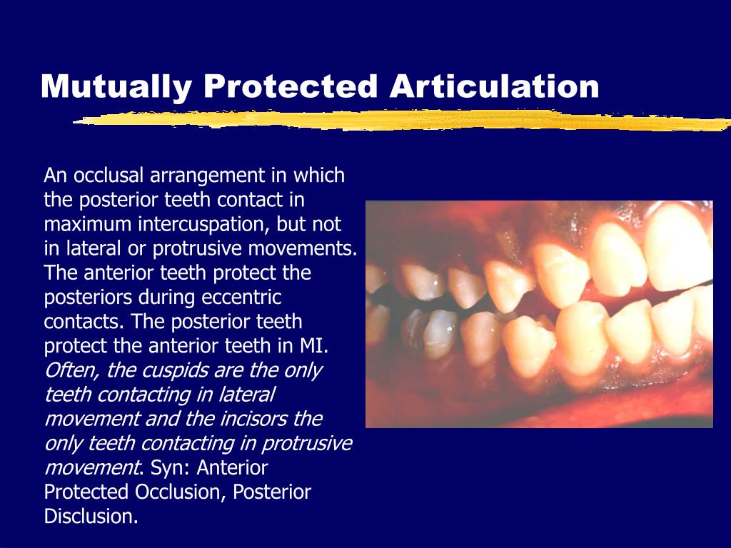 PPT FSBGD Occlusion Review PowerPoint Presentation, free download