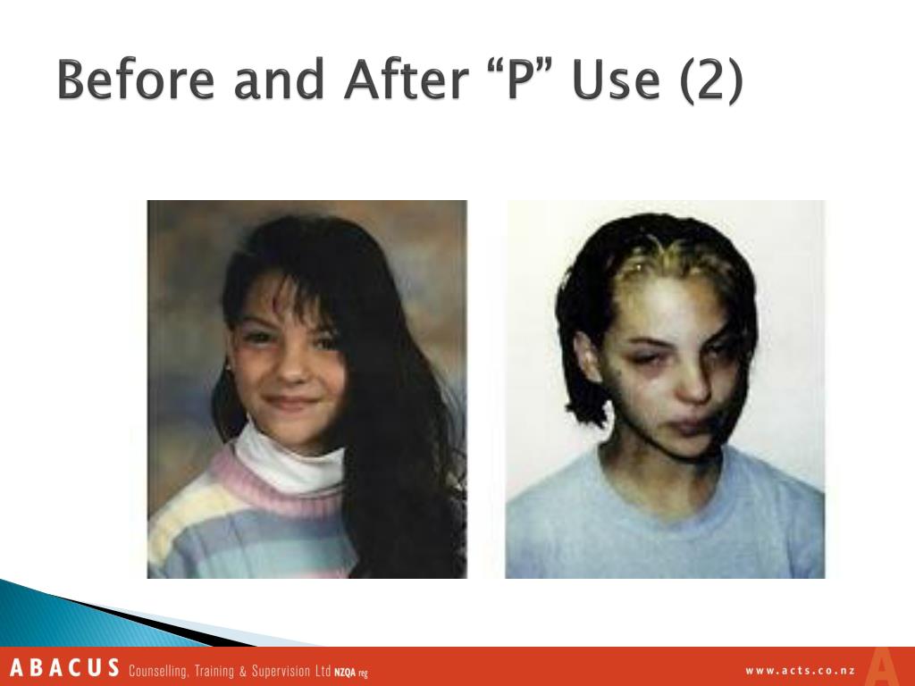 PPT Alcohol, Drug and Youth PowerPoint Presentation, free download PPT Alcohol, Drug and Youth PowerPoint Presentation, free download