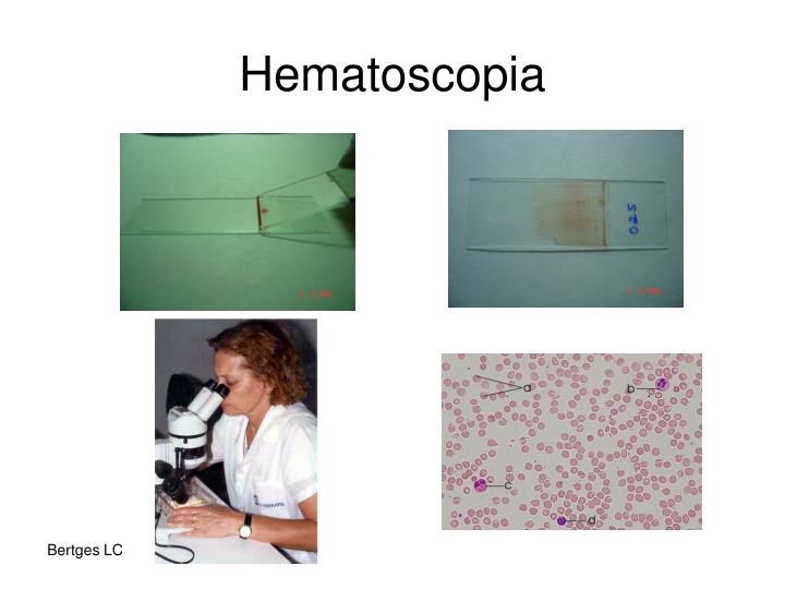 PPT Interpretação do Hemograma (Leucograma) PowerPoint Presentation