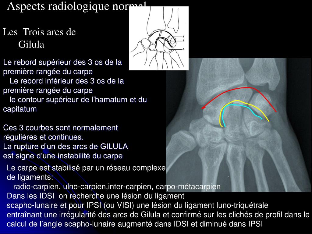 PPT ANATOMIE RADIOLOGIQUE DU PowerPoint