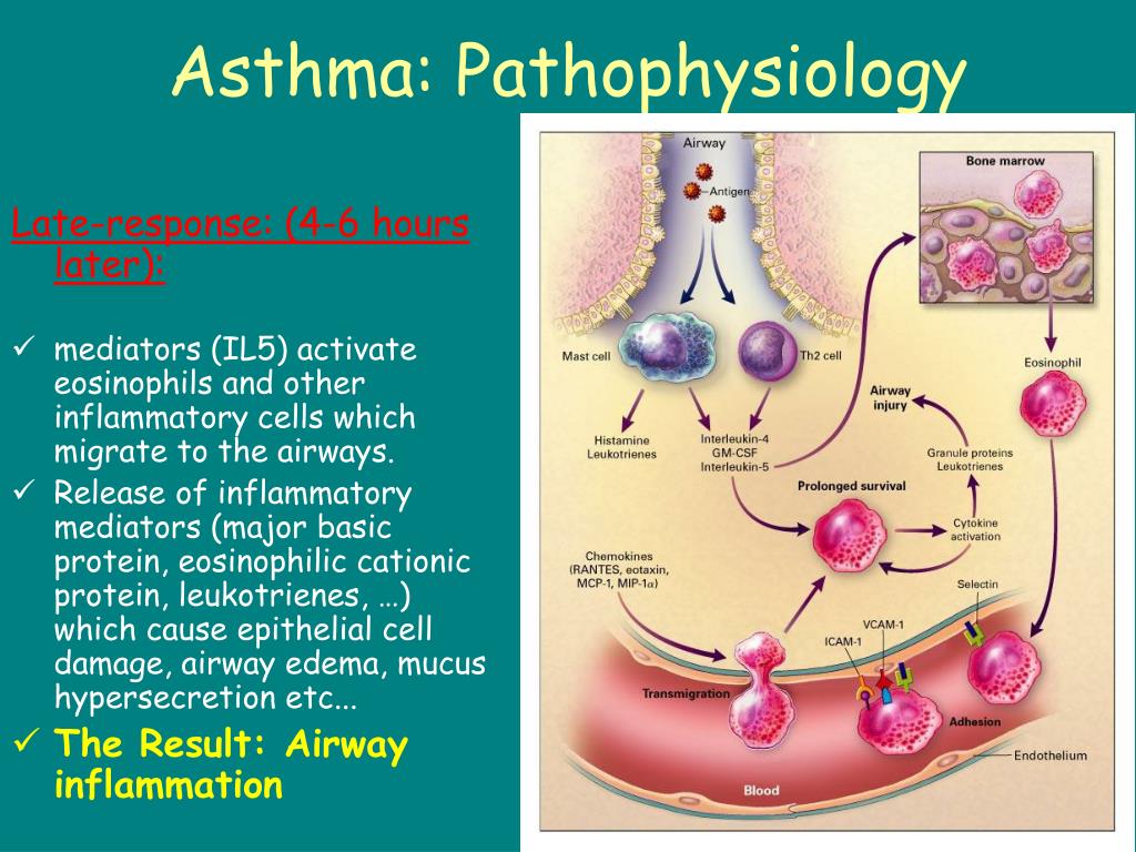 PPT Asthma in childhood PowerPoint Presentation, free download ID