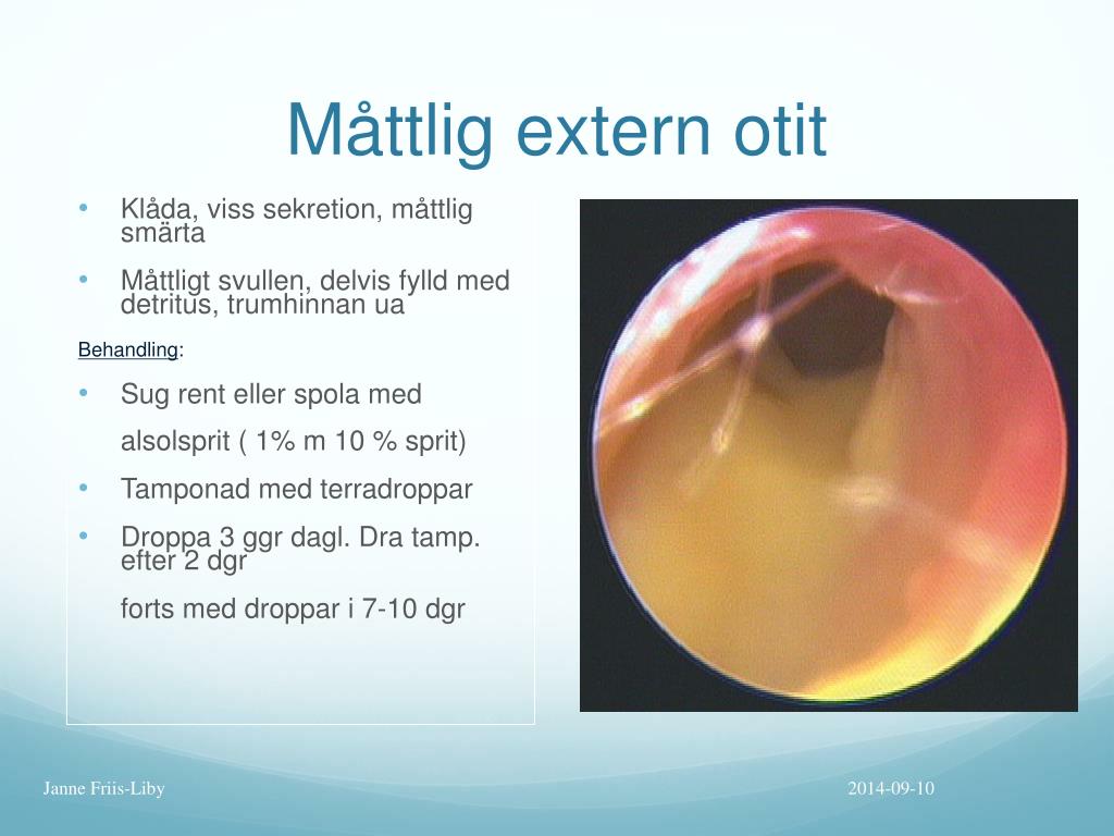 PPT Hörselgången PowerPoint Presentation, free download ID4193810
