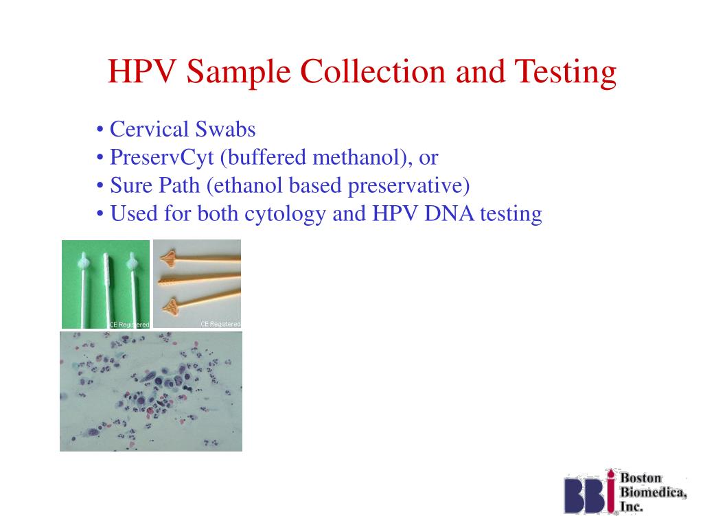 PPT Controls for Human Papilloma Virus (HPV) DNA testing PowerPoint
