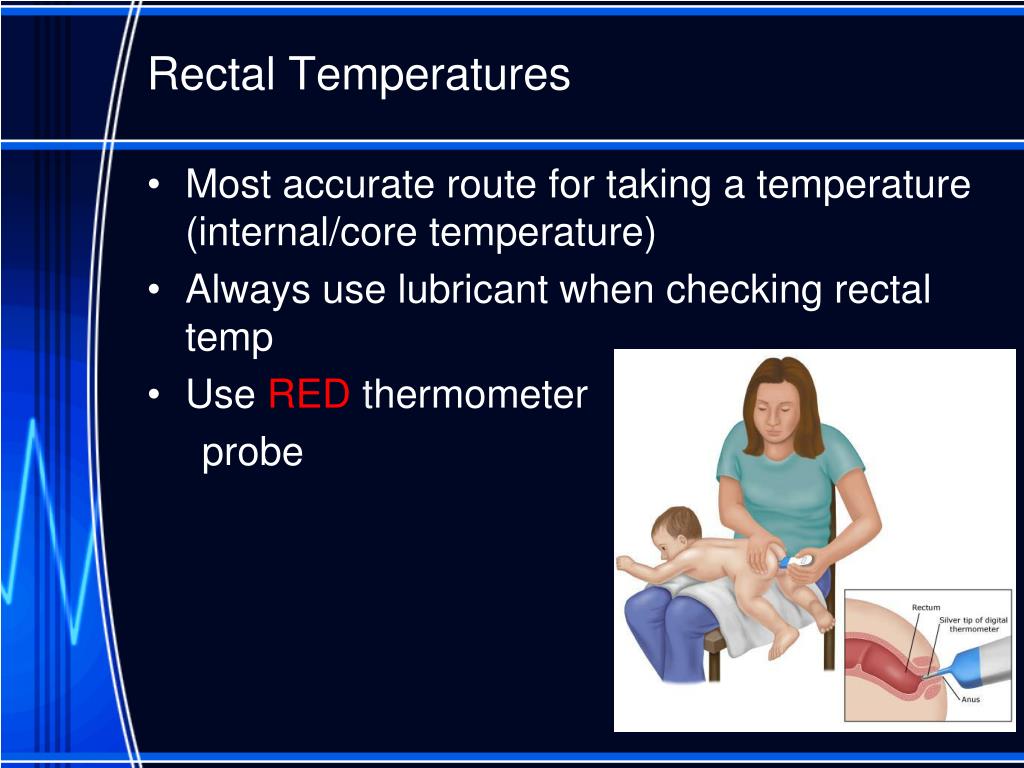 PPT Vital Signs PowerPoint Presentation, free download ID4224949
