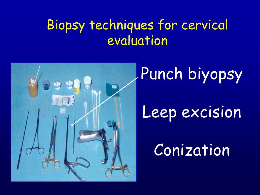 PPT Cervical cancer PowerPoint Presentation, free download ID4231707