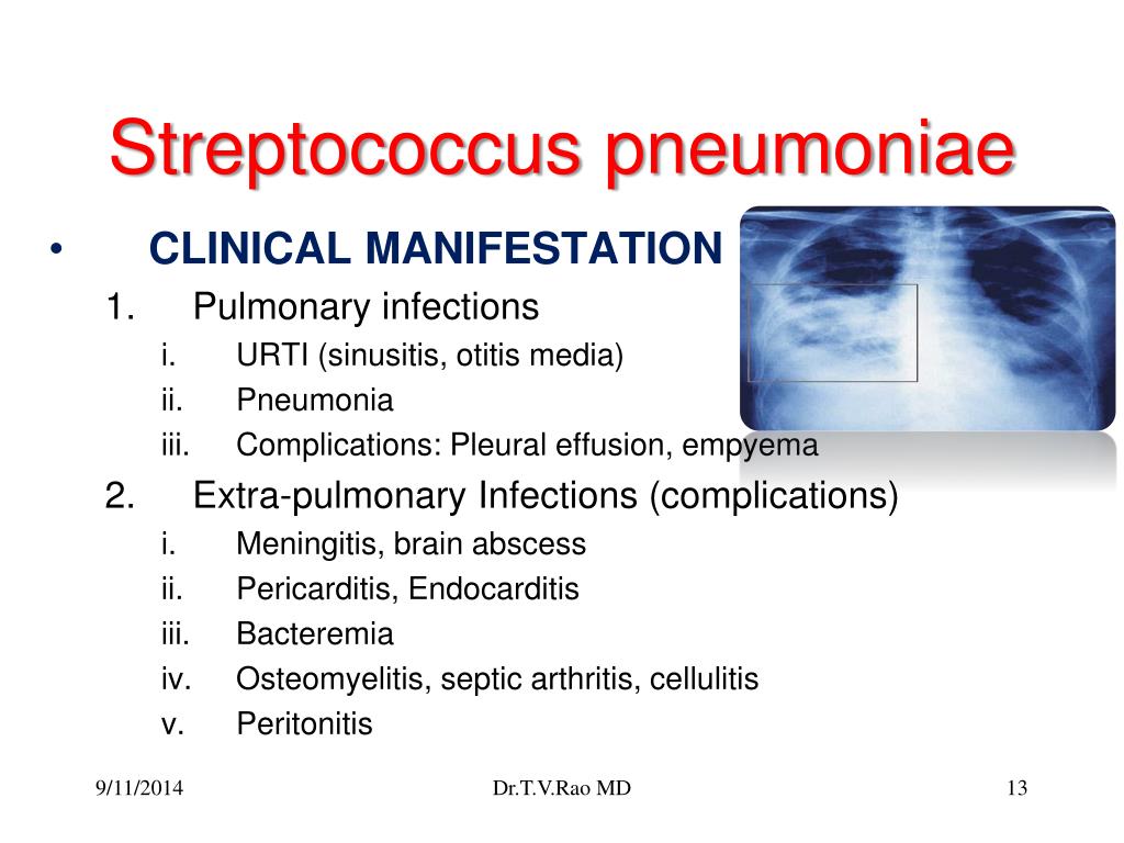 PPT Streptococcus pneumoniae pneumococcus PowerPoint Presentation