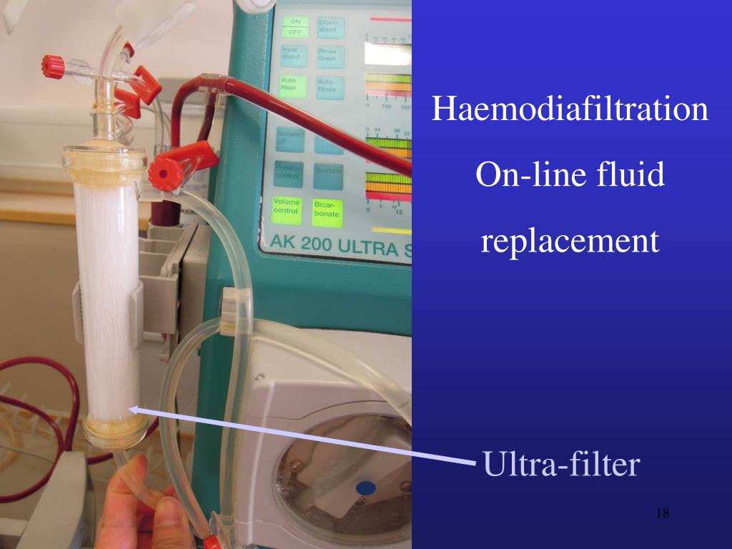 PPT New Developments in Renal Dialysis PowerPoint Presentation, free