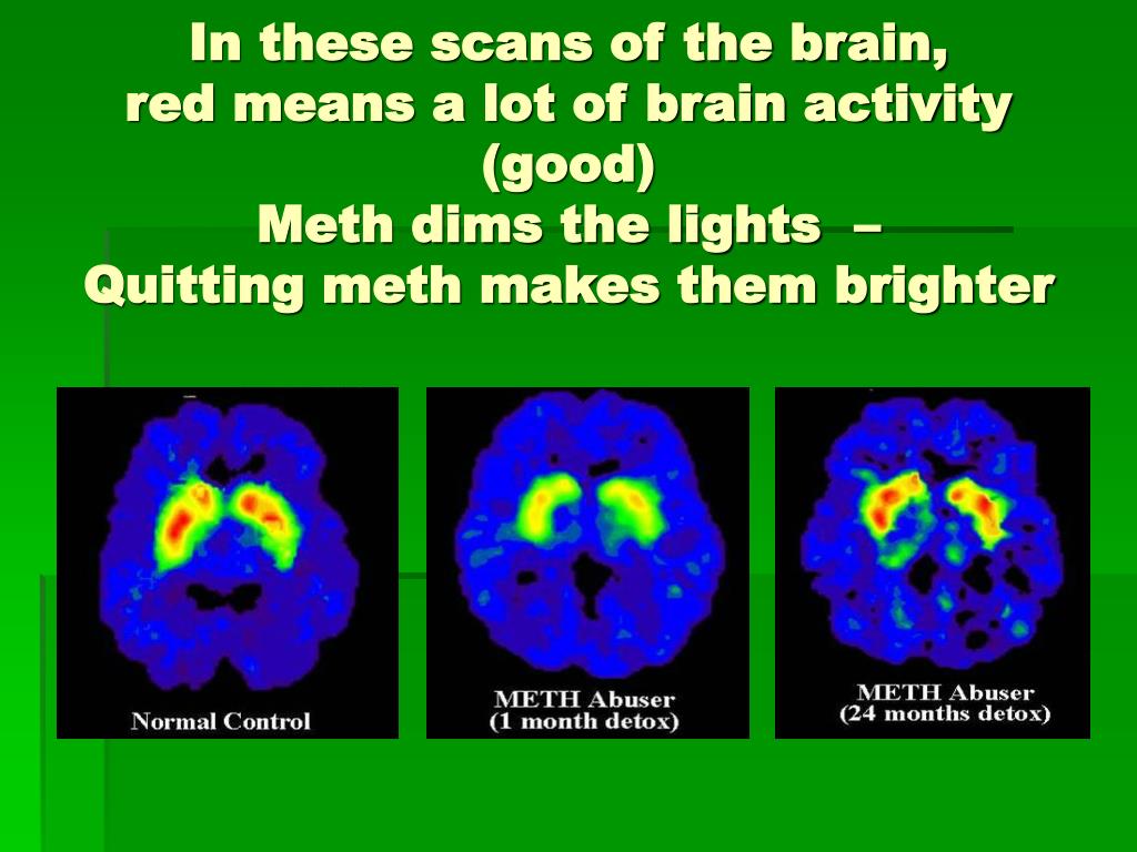 PPT Methamphetamine Is a powerful Central Nervous System Stimulant