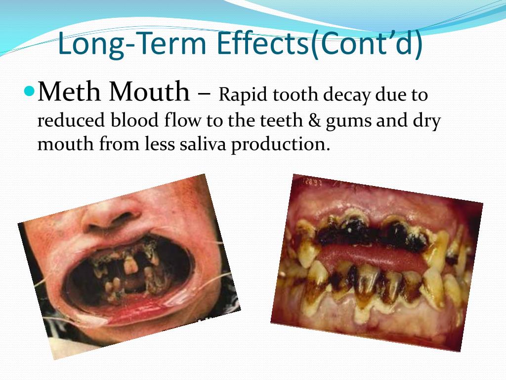 PPT Crystal Meth PowerPoint Presentation, free download