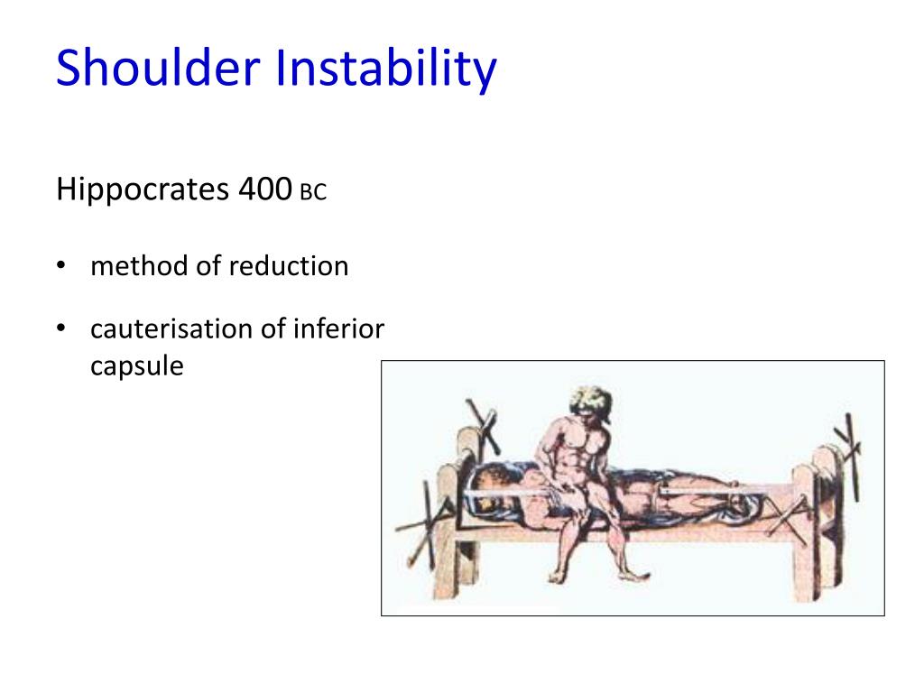 PPT Surgical treatment of shoulder sports injuries PowerPoint