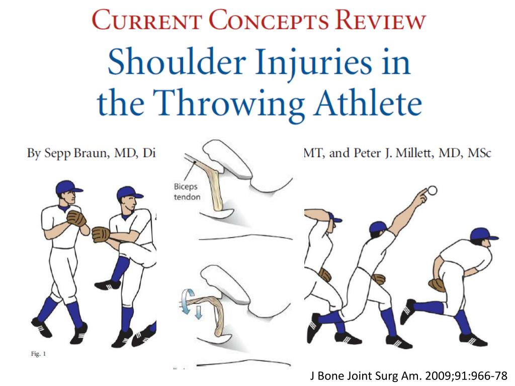PPT Surgical treatment of shoulder sports injuries PowerPoint