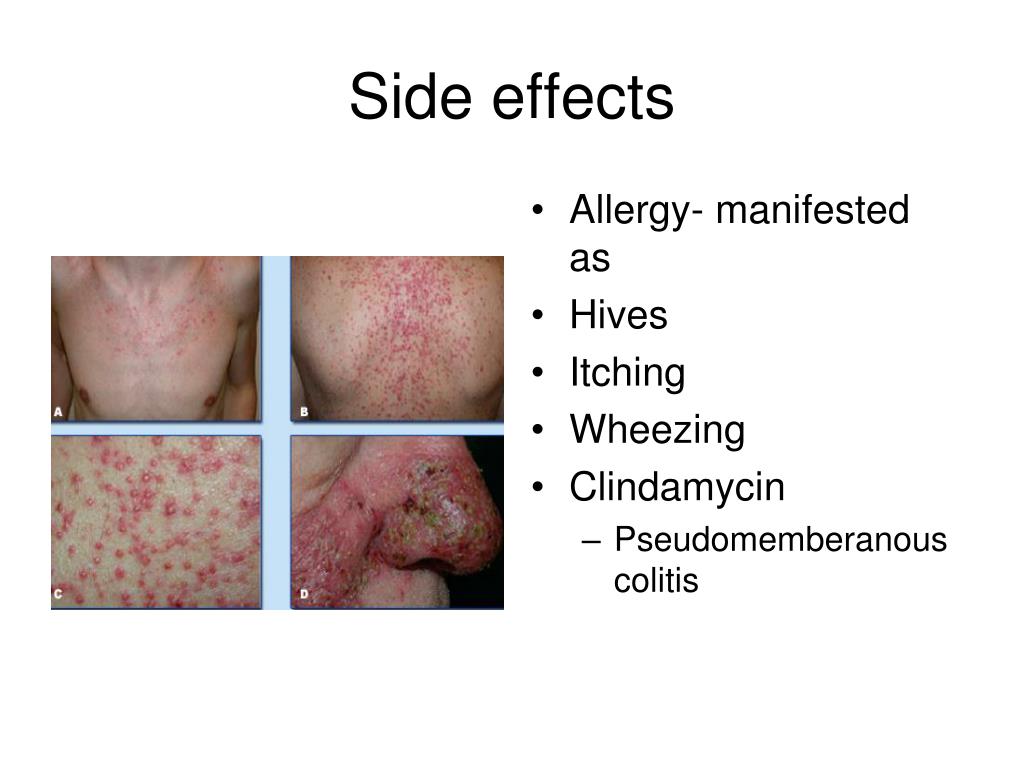 PPT Antibiotic Chemotherapy for Oral & Maxillofacial Surgery