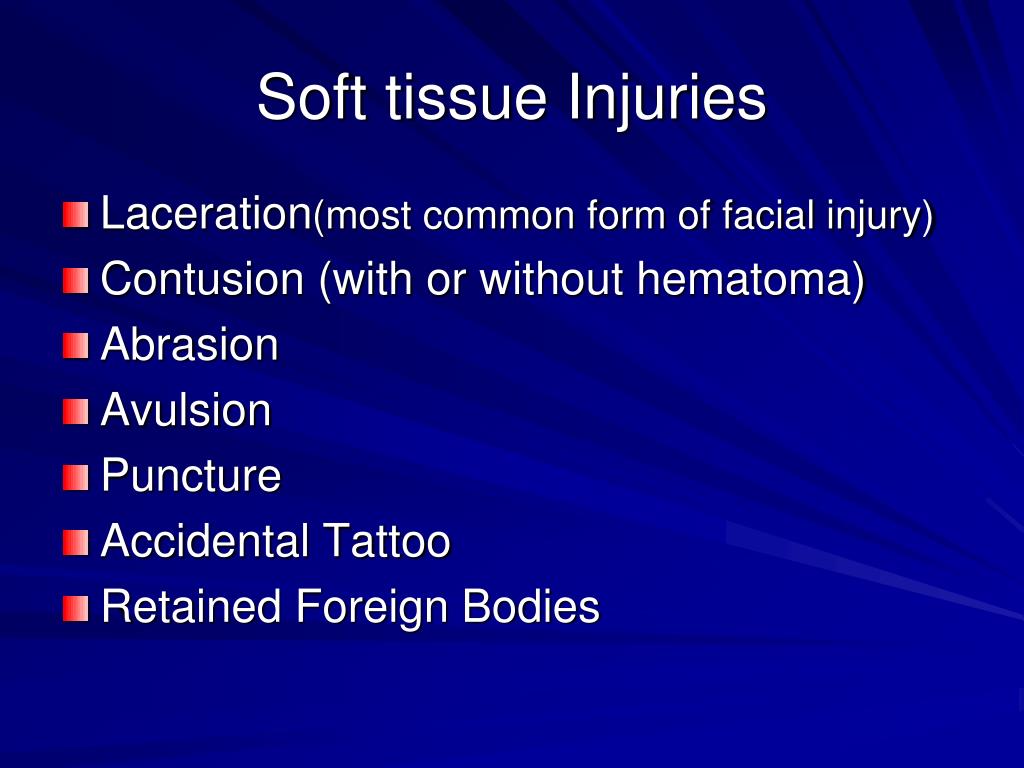 PPT Facial Injuries PowerPoint Presentation, free download ID4281313