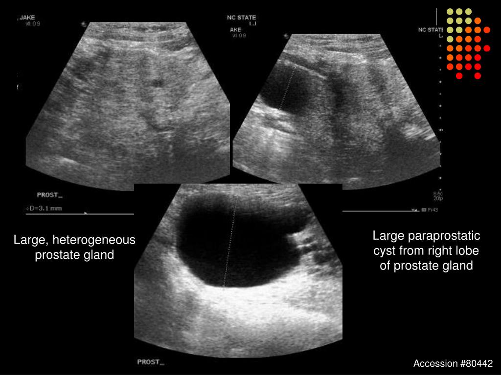 PPT Canine Paraprostatic Cyst PowerPoint Presentation, free download