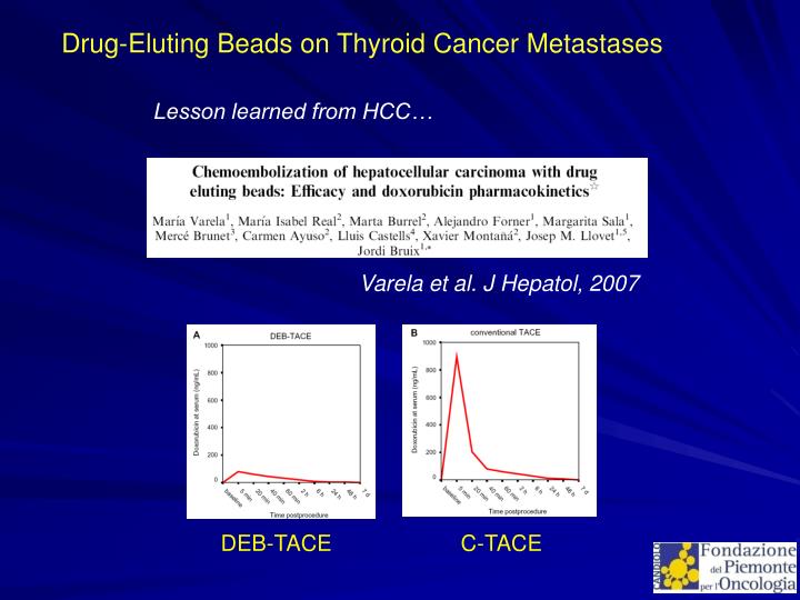 PPT DrugEluting Beads on Thyroid Cancer Metastasis Early Experience