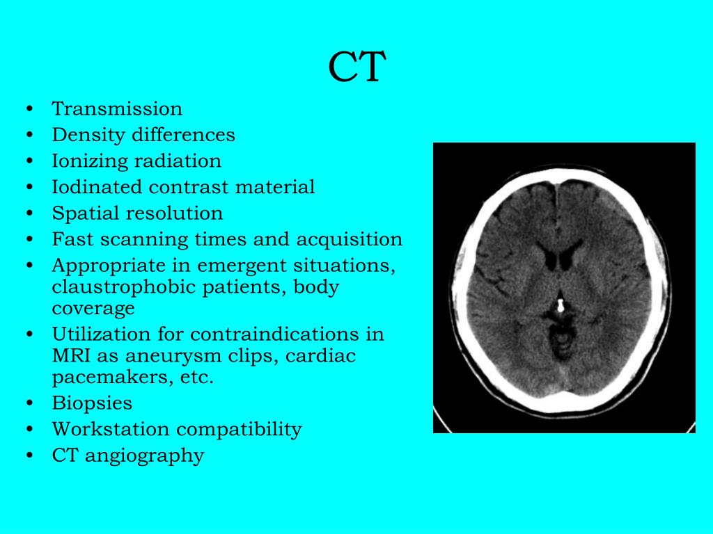 PPT NeuroImaging PowerPoint Presentation, free download ID4358364