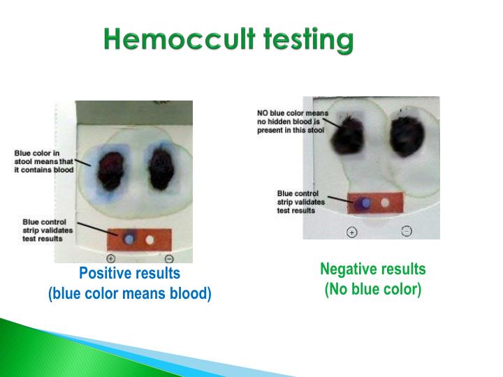 PPT Specimen Collection PowerPoint Presentation ID4367449