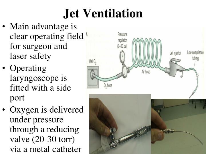 PPT Laser Surgery of the Airway PowerPoint Presentation ID4378408