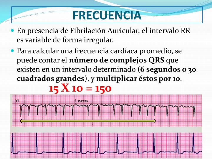 PPT Lectura e interpretación del electrocardiograma PowerPoint