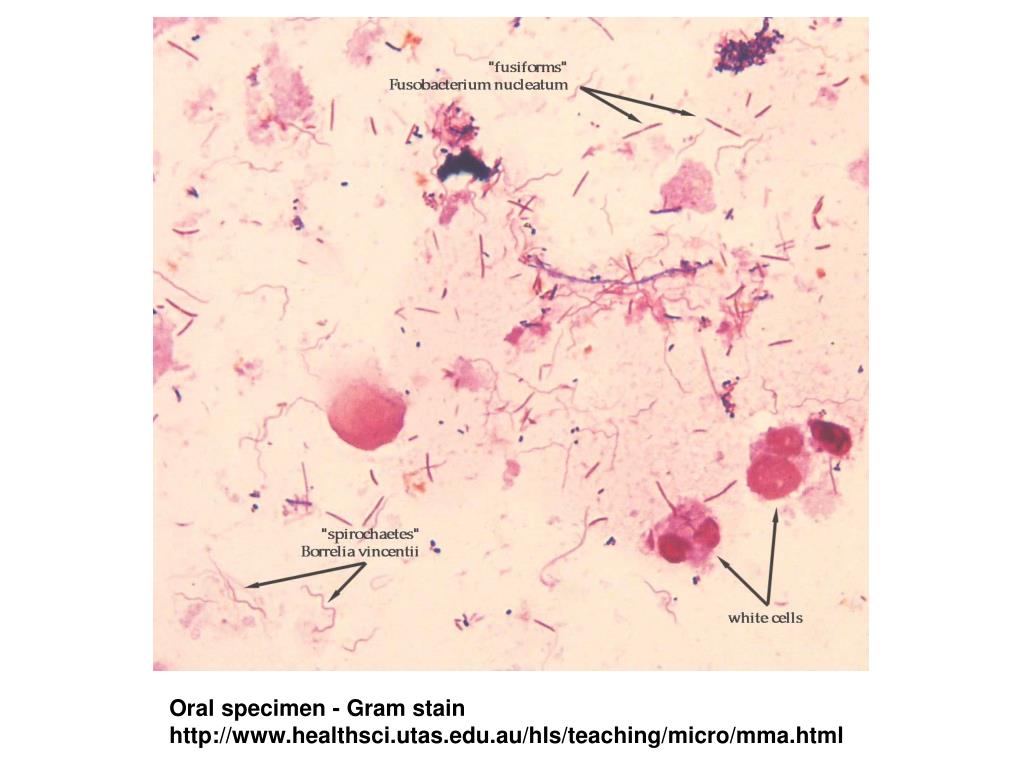 PPT EPID 525 Lecture 2 PowerPoint Presentation, free download ID