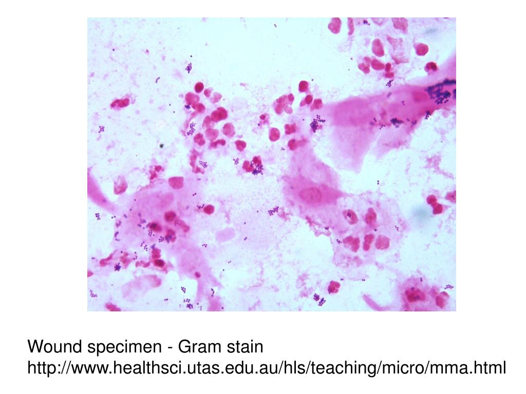 PPT EPID 525 Lecture 2 PowerPoint Presentation, free download ID