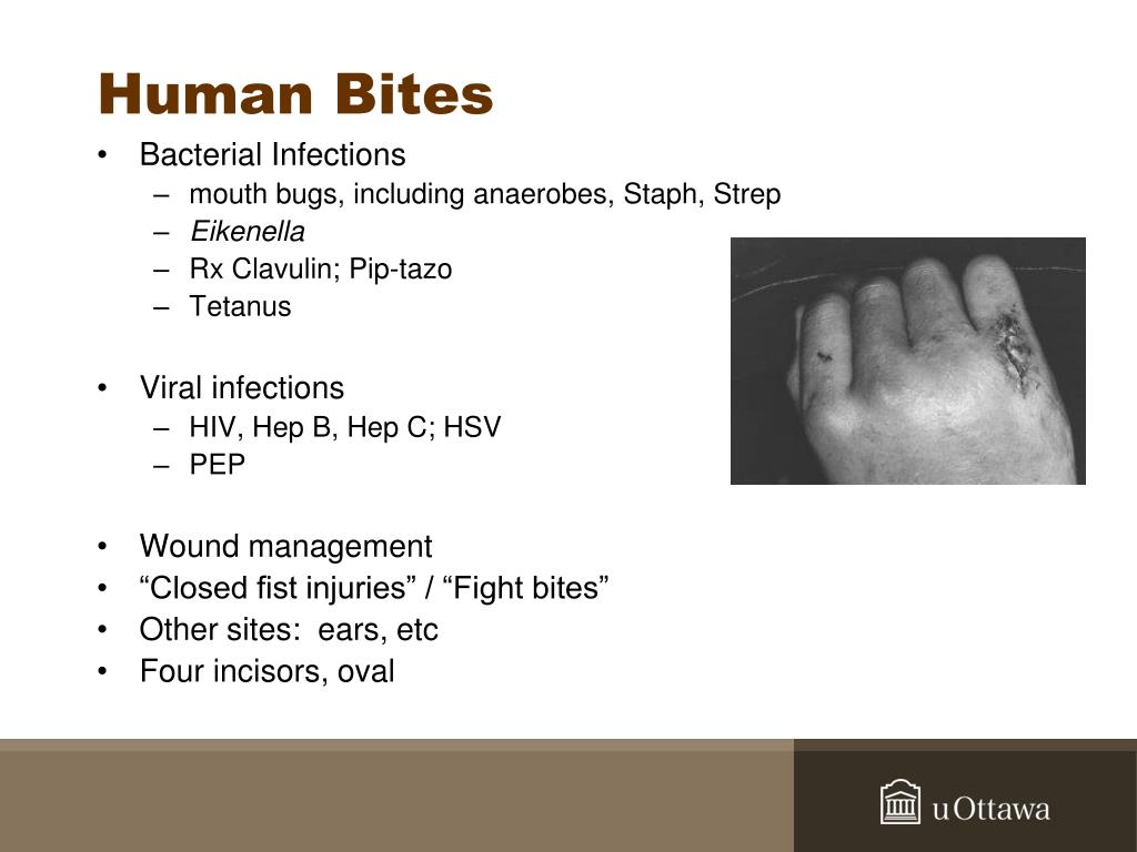 PPT That Bites! Back to Basics Review PowerPoint Presentation, free