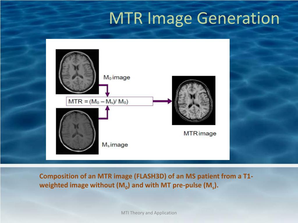 PPT Transfer Imaging Theory and Clinical Applications