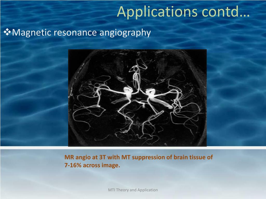 PPT Transfer Imaging Theory and Clinical Applications