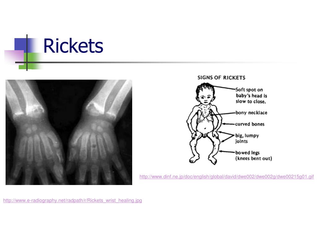 PPT Vitamins PowerPoint Presentation, free download ID4421149