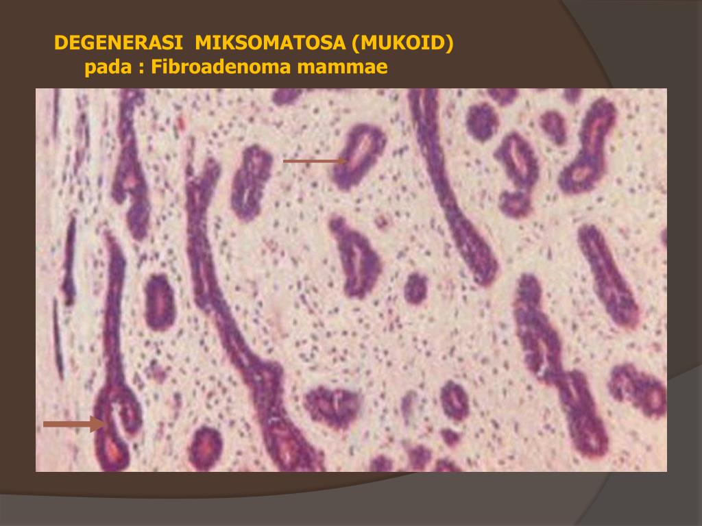 Mukoid Adalah The Letter