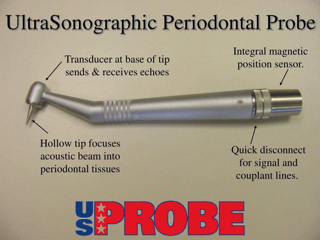PPT UltraSonographic Perio Probe A painless way to monitor