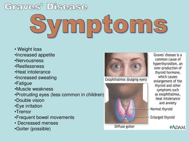 Overactive thyroid (hyperthyroidism) Symptoms NHS