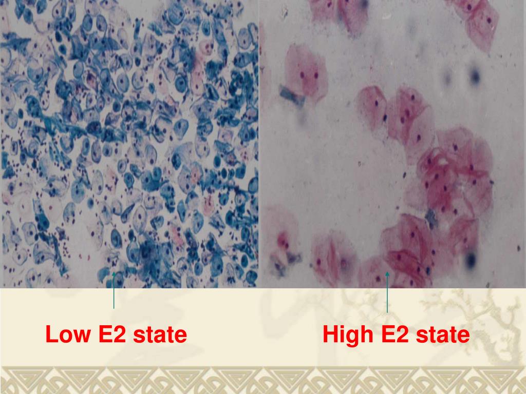 PPT Reproductive Endocrinology Related Diseases 生殖内分泌相关疾病 PowerPoint