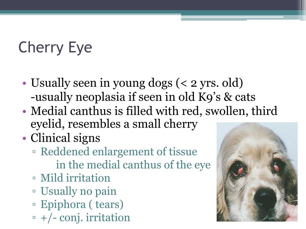 PPT Diseases of the Eye PowerPoint Presentation, free download ID