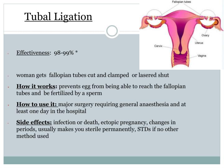 PPT Contraception Methods PowerPoint Presentation ID4474786