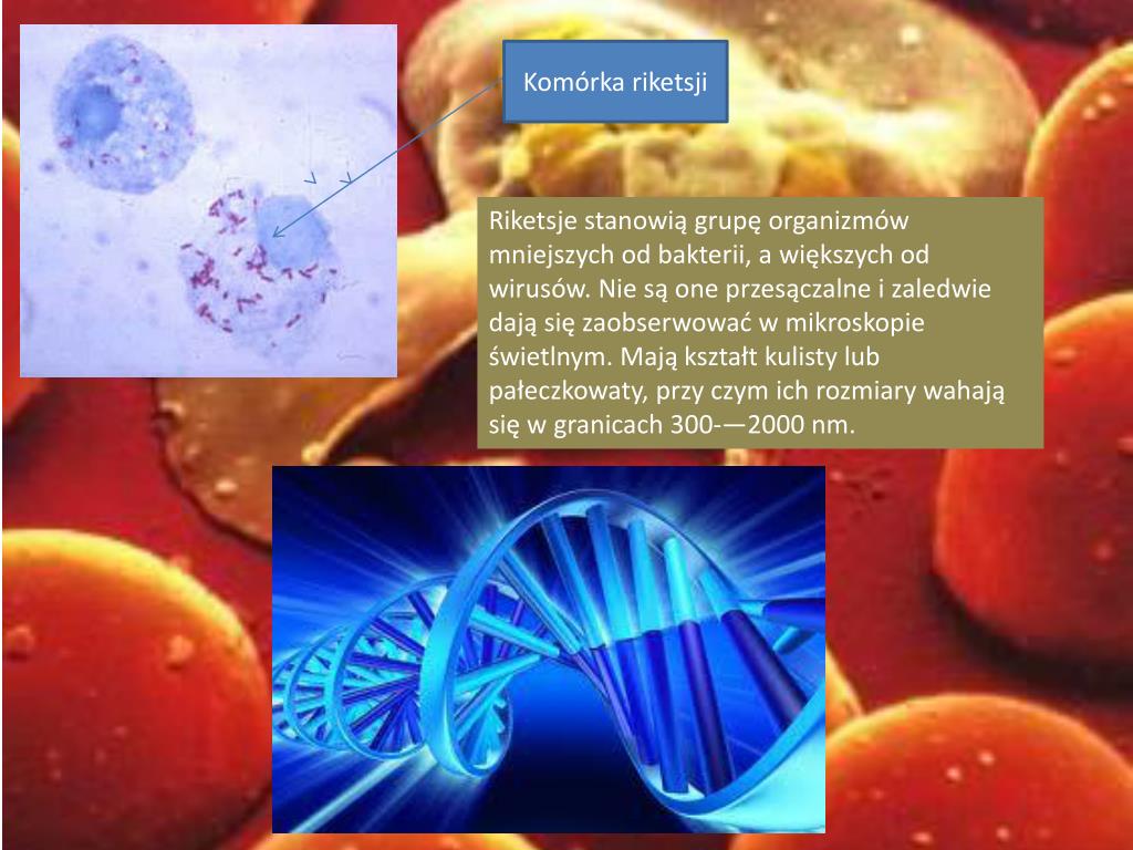 PPT Przyczyny chorób zakaźnych PowerPoint Presentation ID4477389