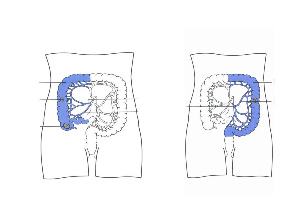 PPT TJOCKTARMS CANCER PowerPoint Presentation, free download ID