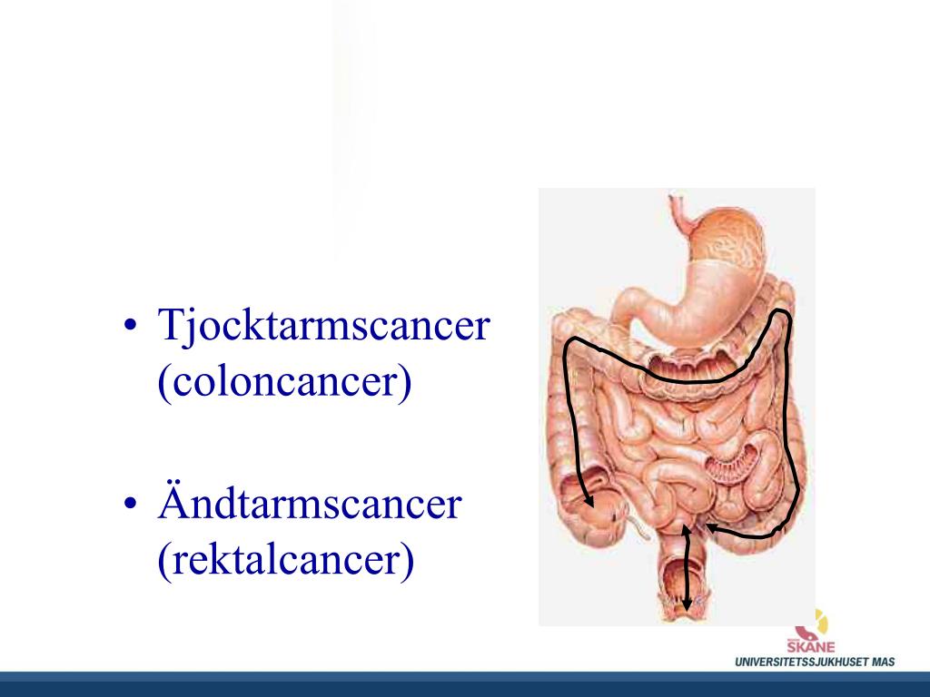 PPT TJOCKTARMS CANCER PowerPoint Presentation, free download ID